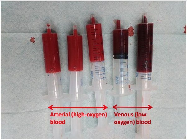 why-was-my-blood-so-dark-when-drawn_1751907183