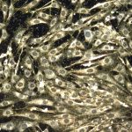 Nanoparticles in the body: New guidance for safety and clarity