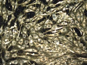 nanoparticles in the body
