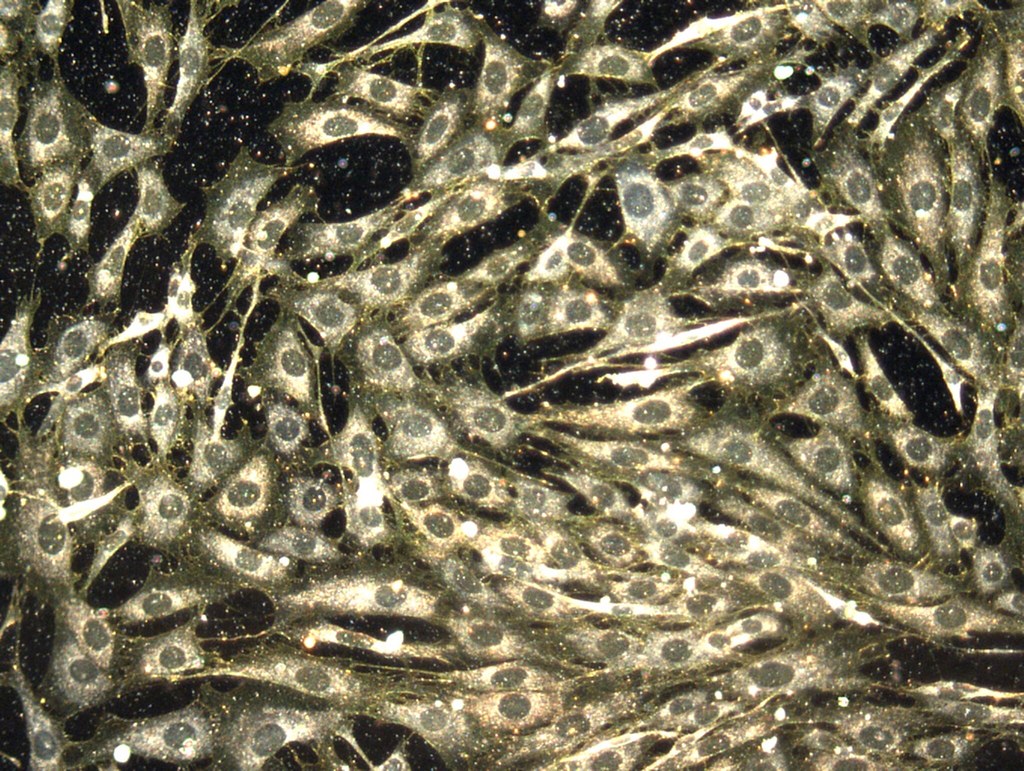nanoparticles in the body
